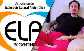 Murió Martín Carrizo: qué es la ELA, sus síntomas y causas | Ela