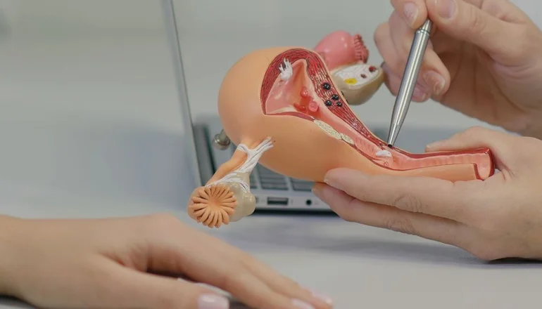 Seis preguntas sobre el cáncer de cuello uterino