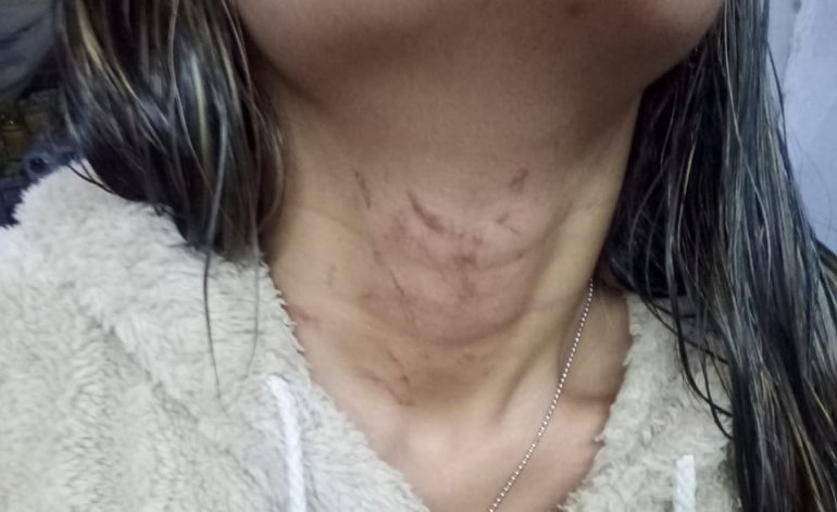 San Juan: una mujer sobrevivió a tres intentos de asesinato y su ex se entregó cuando la creyó muerta San Juan: una mujer sobrevivió a tres intentos de asesinato y su ex se entregó cuando la creyó muerta | El Destape