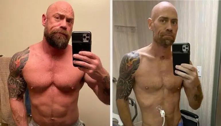 Impactante cambio de un joven que estuvo internado seis semanas por COVID-19