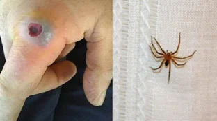 Nena de 1 año murió por la picadura de una "araña de rincón": el bicho asesino vive en las casas y se mueve de noche