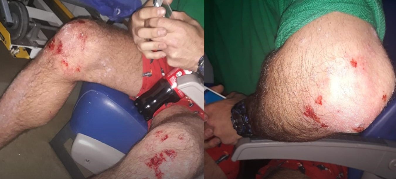 Brutal ataque homofóbico: Un hombre golpeó a una pareja con un látigo